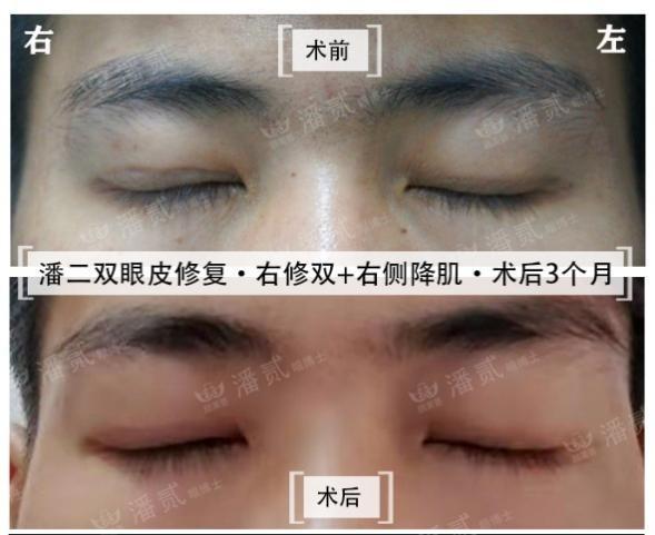 密封固化剂地坪 第13页